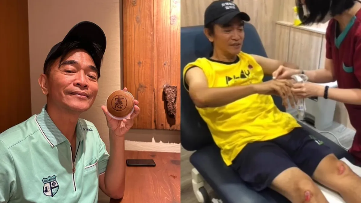 吳宗憲錄影受傷!(圖/翻攝自FB/吳宗憲 Jacky Wu)