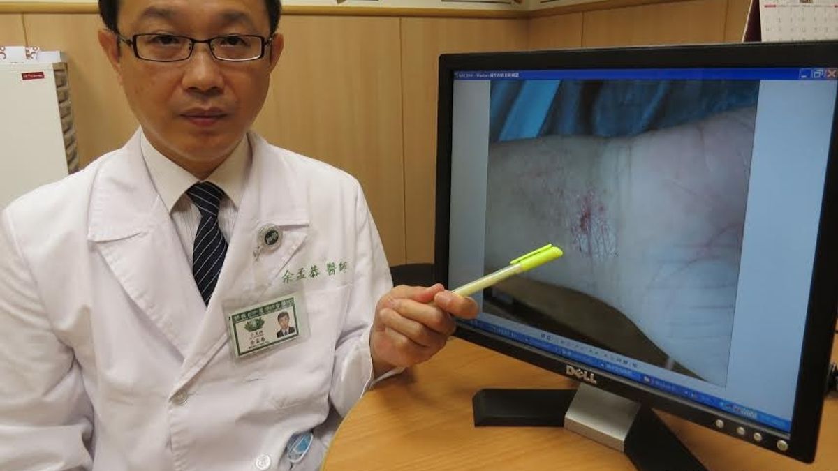 異位性皮膚炎惡化? 當心是家中毛小孩惹禍 異位性皮膚炎惡化? 當心是家中毛小孩惹禍