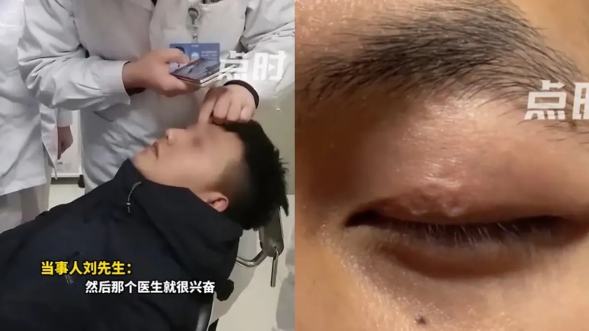 男子眼睛感染寄生蟲。(圖/翻攝自微博/點時新聞) 男子眼睛感染寄生蟲。(圖/翻攝自微博/點時新聞)