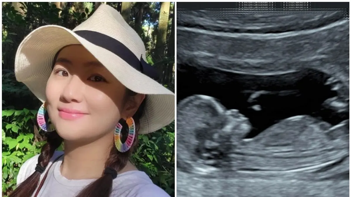 Selina曝光寶寶的超音波照。(圖/翻攝自IG@selinanahaha)