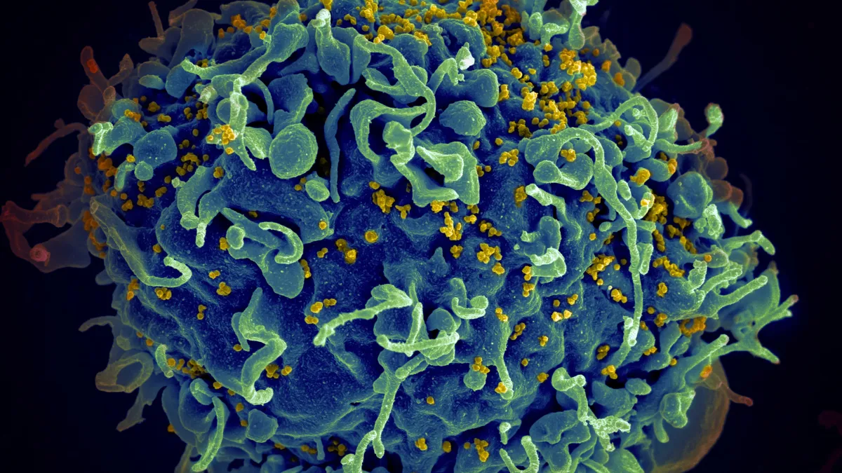 正在感染人體細胞的愛滋病毒( @National Cancer Institute/Unsplash)