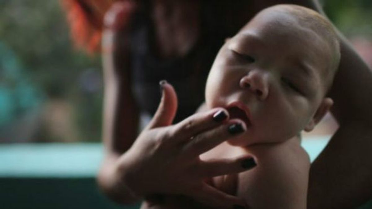 茲卡病毒可以攻擊人的免疫系統,並導致嬰幼兒腦發育不全。(BBC中文網) 茲卡病毒可以攻擊人的免疫系統,並導致嬰幼兒腦發育不全。(BBC中文網)