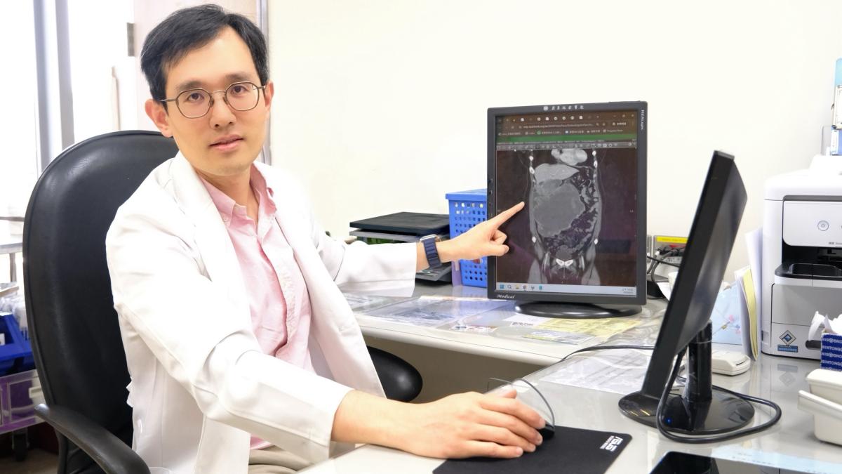 婦人黑便、腹脹竟是「20公分巨大腫瘤」作祟!醫也訝異罕見 精準手術成功切除