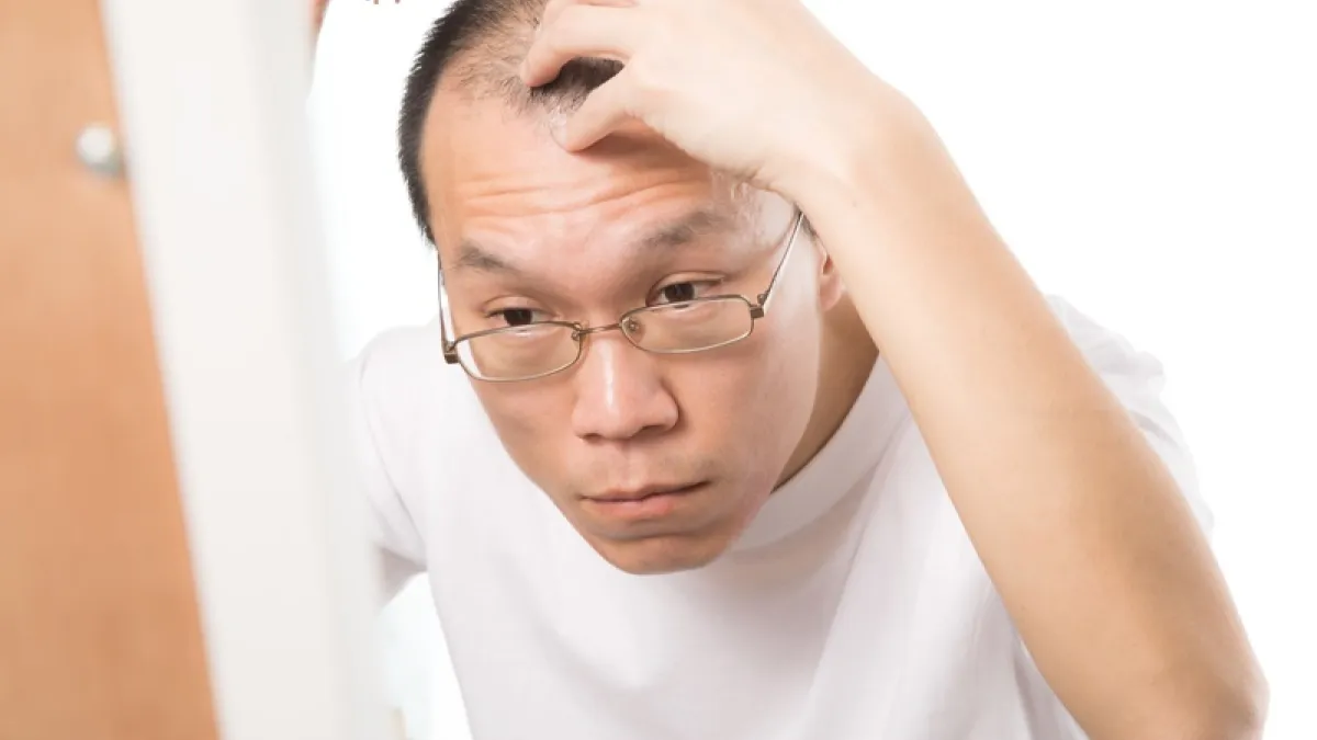 除了頭皮清潔不當會加遽掉髮發生外,曾石姿醫師指出,其實臨床上導致掉髮與禿頭元凶,主要還是與遺傳因素有關。(圖/サンライズ鈴木@pakutaso)
