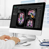 Neurophet Supplies 'Neurophet AQUA' to Raffles Medical in Singapore Neurophet Supplies 'Neurophet AQUA' to Raffles Medical in Singapore