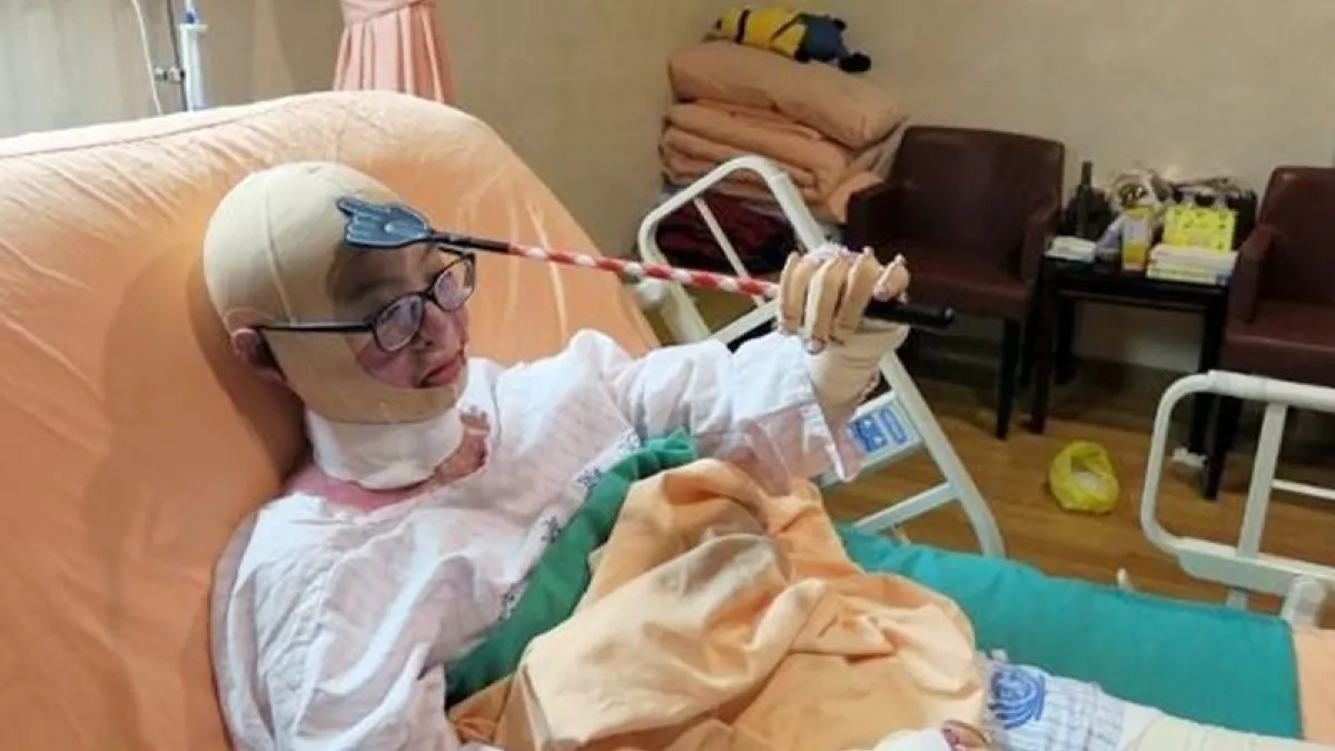 戴著壓力頭套,依欣只能用不求人止癢。(圖/時報出版提供)