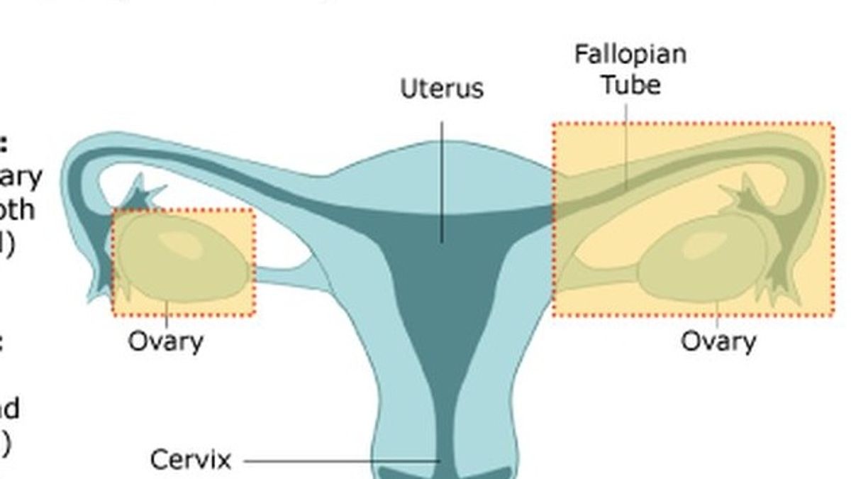 預防性卵巢摘除,或可預防婦女癌症。(取自網路) 預防性卵巢摘除,或可預防婦女癌症。(取自網路)