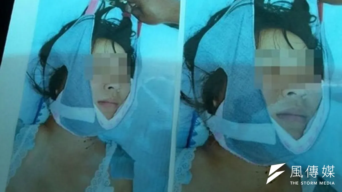 河南兩名少女被送去治療網癮的學校,疑因不當體能操練一死一傷,圖為頸髓損傷的14歲少女欣欣。(取自網路) 河南兩名少女被送去治療網癮的學校,疑因不當體能操練一死一傷,圖為頸髓損傷的14歲少女欣欣。(取自網路)