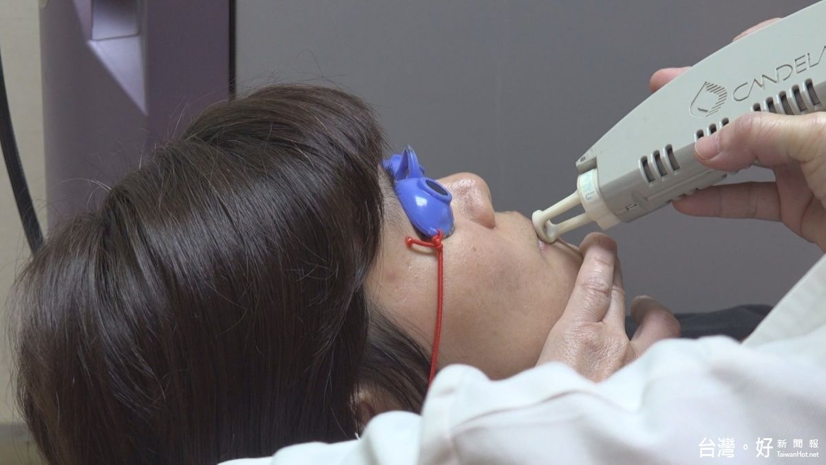 嘴唇長「草莓」腫塊 當心罹患血管瘤 嘴唇長「草莓」腫塊 當心罹患血管瘤