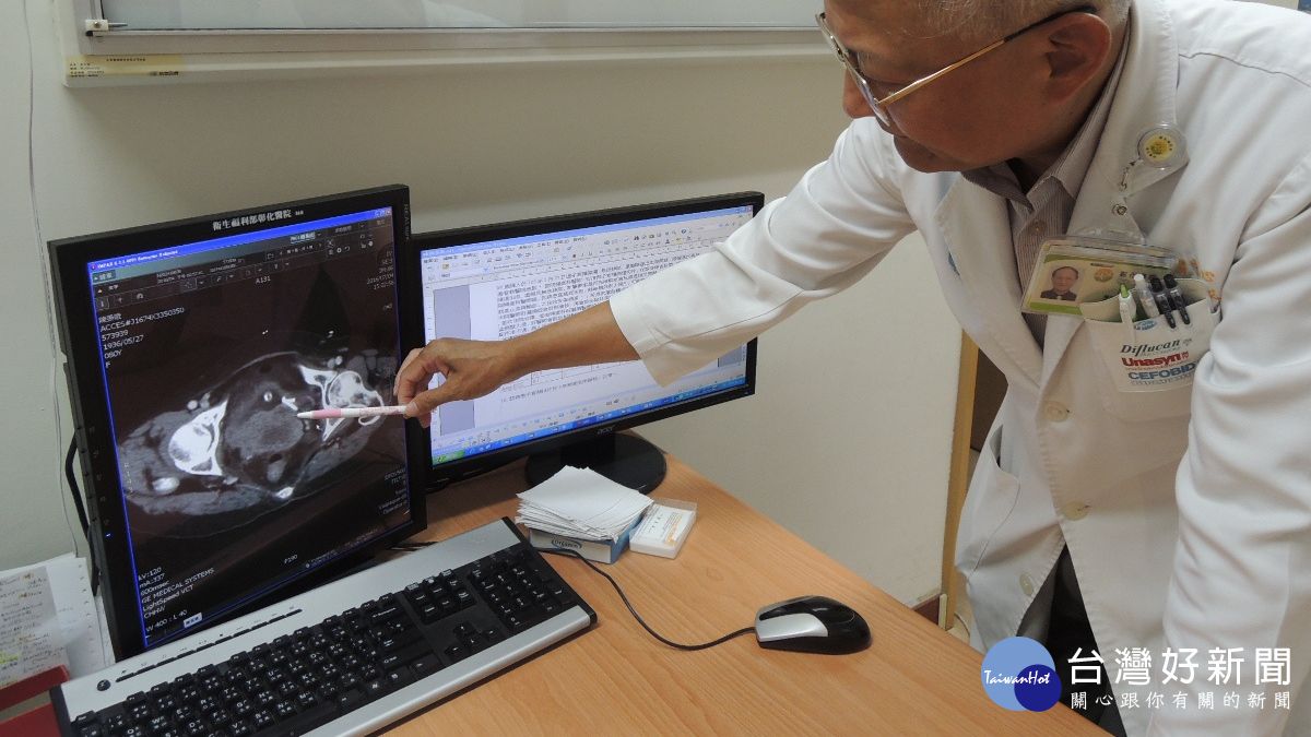 3年沒做子宮頸抹片檢查 阿嬤小便出血已是癌末期 3年沒做子宮頸抹片檢查 阿嬤小便出血已是癌末期