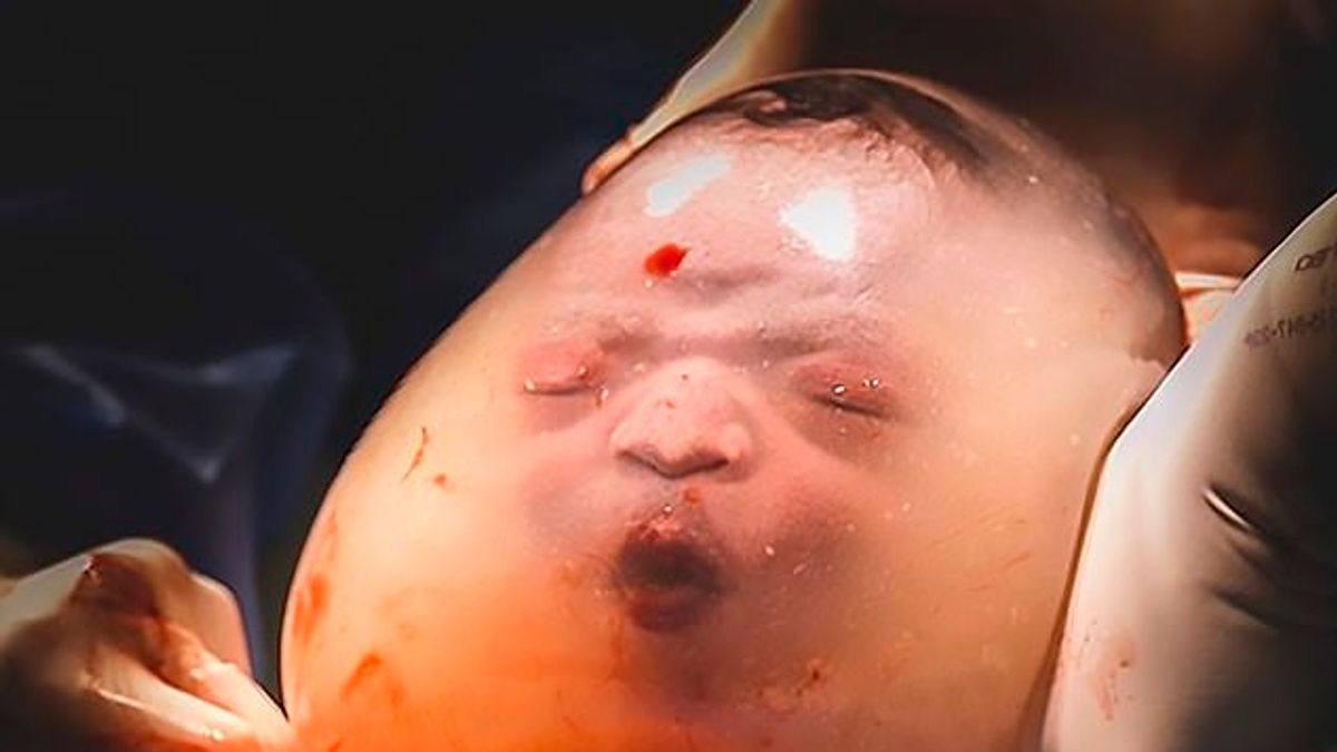 巴西一名產婦羊水未破就產下男嬰,攝影師拍下超罕見奇景,瘋傳全網!(圖/JanaBrasil Fotografia @ instagram) 巴西一名產婦羊水未破就產下男嬰,攝影師拍下超罕見奇景,瘋傳全網!(圖/JanaBrasil Fotografia @ instagram)