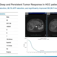 ASCO 2026 | Oricell's GPC3 CAR-T Ori-C101 Hits 66.7% ORR in Late-Line HCC, Signaling Best-in-Class Potential ASCO 2026 | Oricell's GPC3 CAR-T Ori-C101 Hits 66.7% ORR in Late-Line HCC, Signaling Best-in-Class Potential