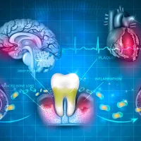 Porphyromonas gingivalis has been detected in the brains of Alzheimer's patients, and studies point to its ability to cross the blood-brain barrier and drive neuroinflammation. (File photo, from a YouTube video) Porphyromonas gingivalis has been detected in the brains of Alzheimer's patients, and studies point to its ability to cross the blood-brain barrier and drive neuroinflammation. (File photo, from a YouTube video)