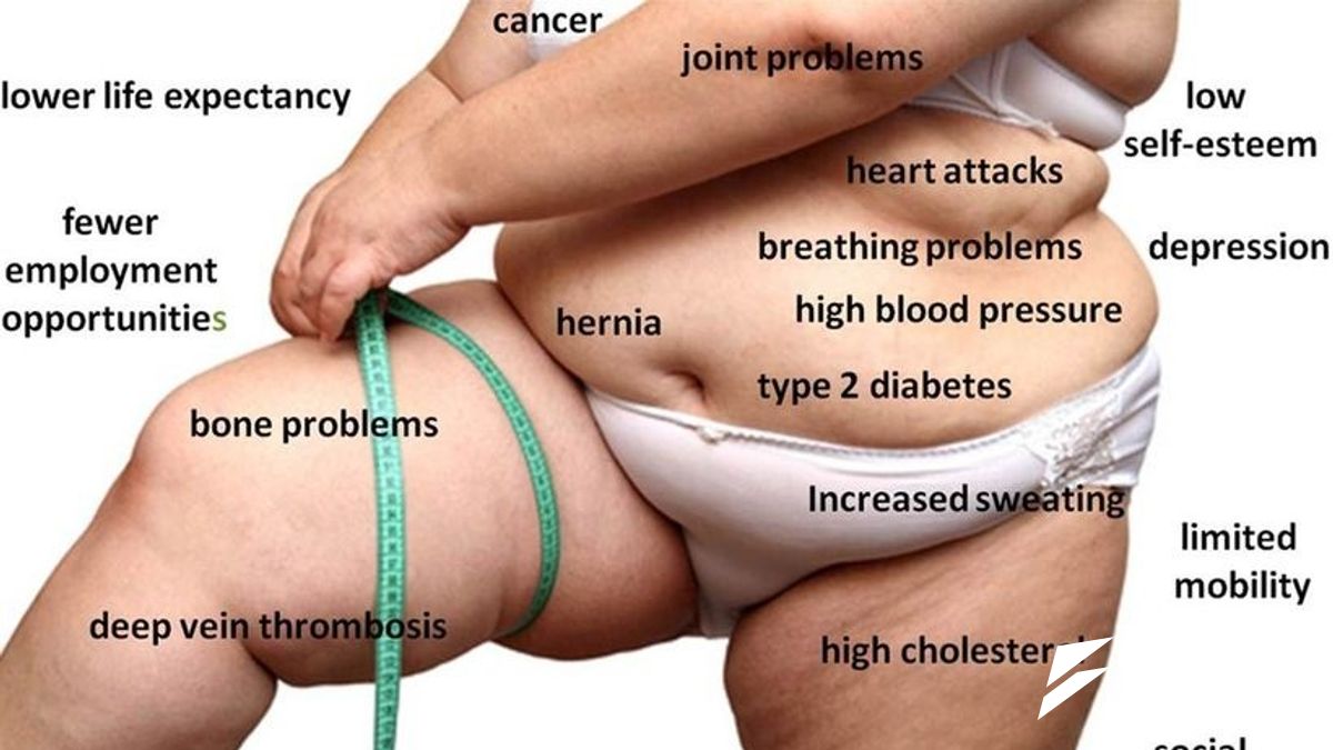 現代人肥胖原因之一,或可能是飲食環境的改變。(取自網路) 現代人肥胖原因之一,或可能是飲食環境的改變。(取自網路)