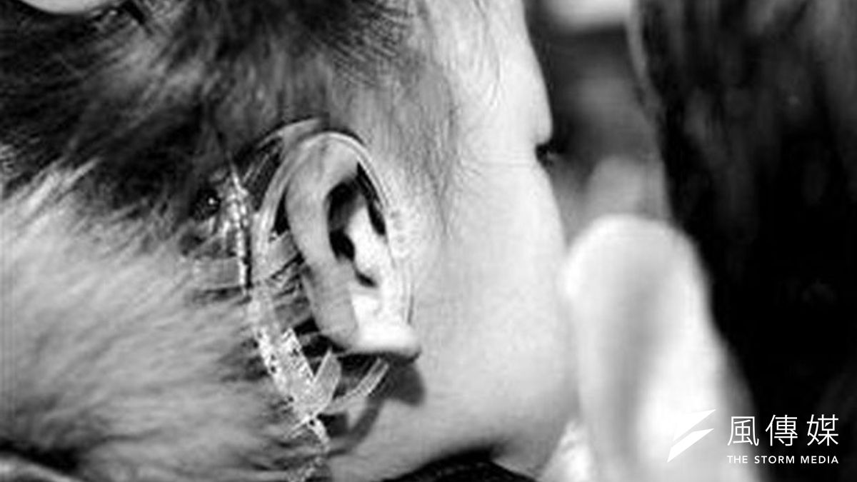 寧夏銀川女童的人工電子耳掉在街頭,全城動員幫忙找回。(取自新京報) 寧夏銀川女童的人工電子耳掉在街頭,全城動員幫忙找回。(取自新京報)