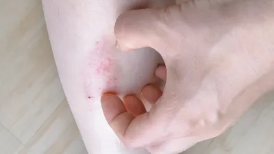 寒冷天氣中帶來的冬日寒風往往令我們的肌膚感到乾燥、緊繃(示意圖/取自photo-ac)
