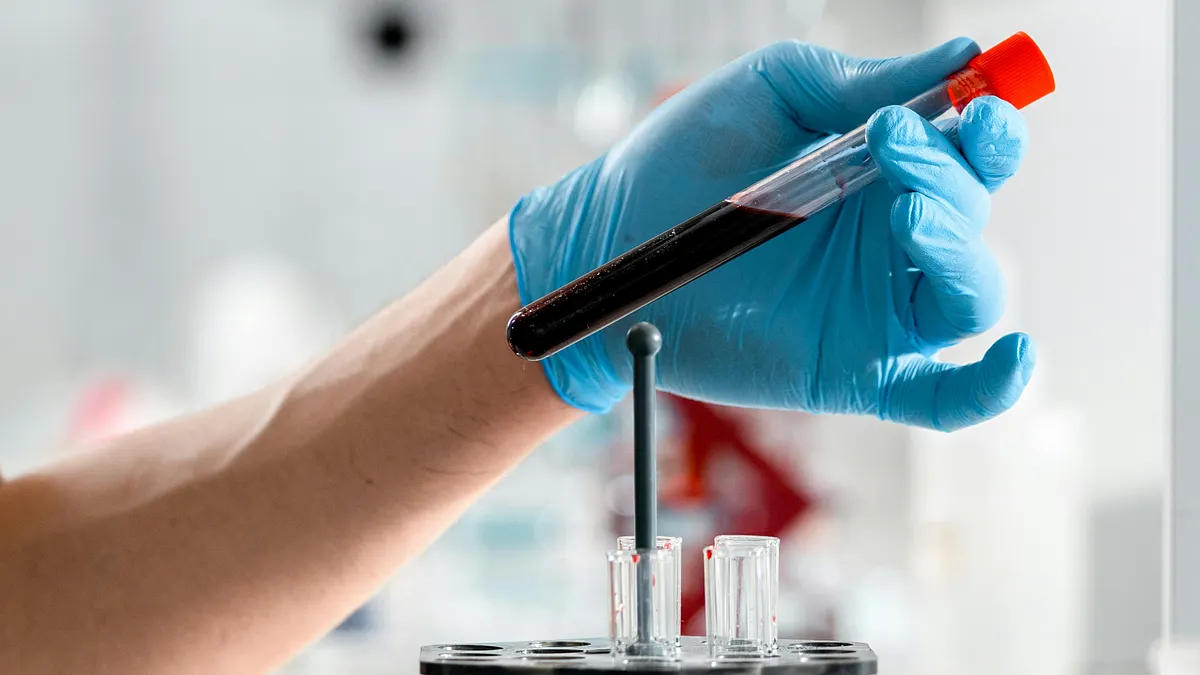 人工血液製品の利点の一つは、血液型の適合を気にする必要がない点である。さらに通常の赤血球よりも小型であるため、脳卒中や血栓によって閉塞した部位などにも到達できる可能性がある。(写真/Pexels提供) 人工血液製品の利点の一つは、血液型の適合を気にする必要がない点である。さらに通常の赤血球よりも小型であるため、脳卒中や血栓によって閉塞した部位などにも到達できる可能性がある。(写真/Pexels提供)