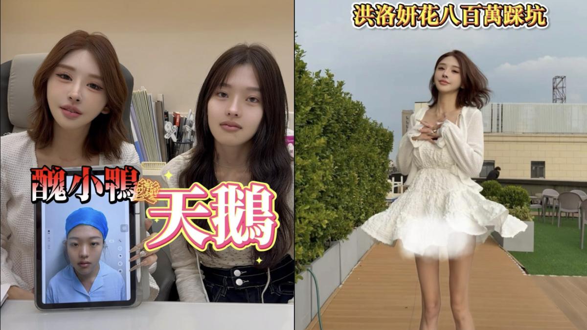「幼態臉」、「精靈耳」與「天鵝頸」 台灣人為何開始到上海「跨境醫美」?