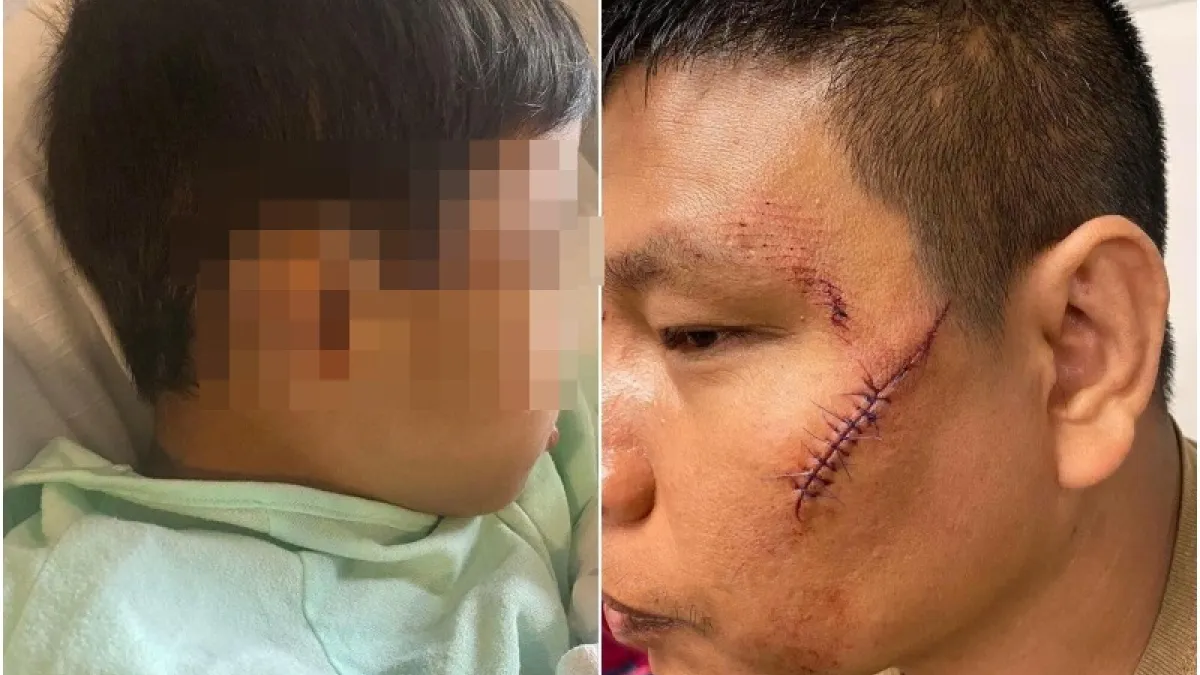 父子在超市被襲擊,傷口皮開肉綻,縫了約數十針。(圖/翻攝自環球時報)