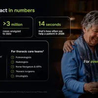 Optellum Celebrates Accelerating Impact in Lung Cancer Care; Now at Over 250 Sites and Growing Optellum Celebrates Accelerating Impact in Lung Cancer Care; Now at Over 250 Sites and Growing