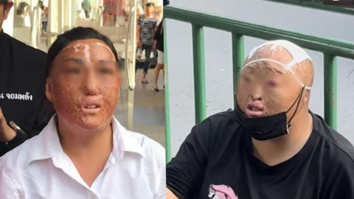 泰國街頭近日發現大批四肢殘缺、毀容的乞丐,沒想到竟都來自中國!(圖/翻攝自微博/泰國網) 泰國街頭近日發現大批四肢殘缺、毀容的乞丐,沒想到竟都來自中國!(圖/翻攝自微博/泰國網)