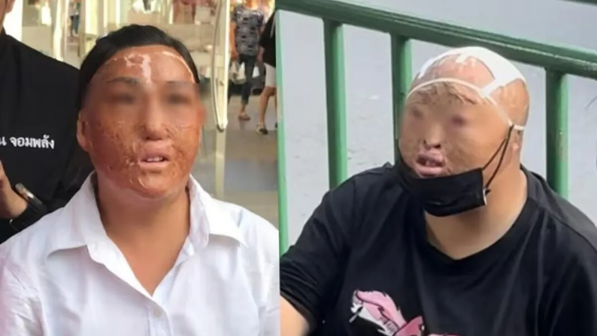 泰國街頭近日發現大批四肢殘缺、毀容的乞丐,沒想到竟都來自中國!(圖/翻攝自微博/泰國網)
