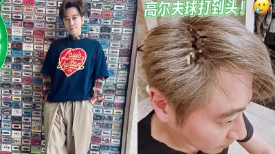 孫耀威慘遭高爾夫球擊中頭部。(圖/翻攝自微博、小紅書/孫耀威)