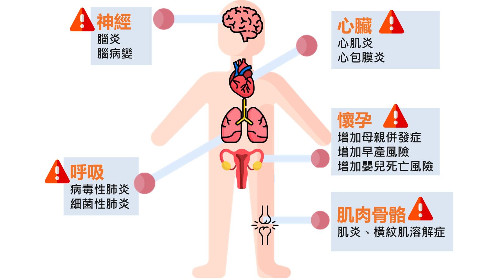 別當一般感冒!流感惡化以「小時」計算 醫示警:夏季疫情不容忽視