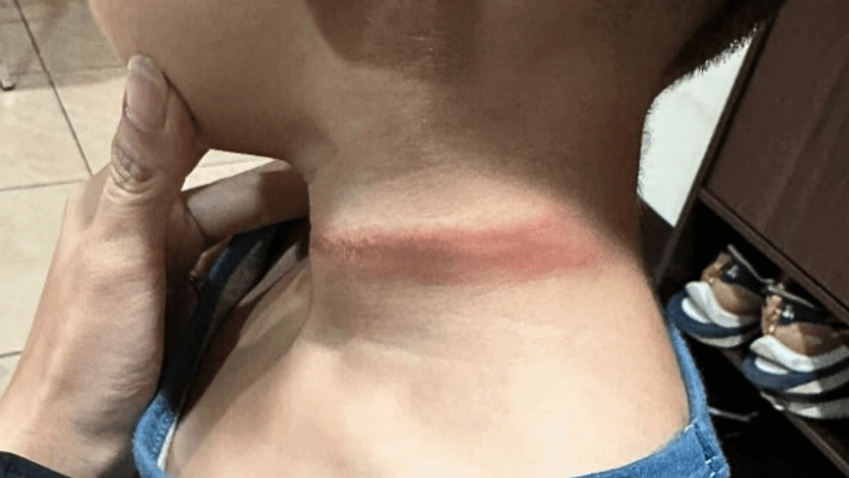 一名家長指控桃園一間幼稚園讓孩童玩拔河,同時老師竟在旁滑手機,導致孩童受傷。(圖/翻攝自爆料公社) 一名家長指控桃園一間幼稚園讓孩童玩拔河,同時老師竟在旁滑手機,導致孩童受傷。(圖/翻攝自爆料公社)