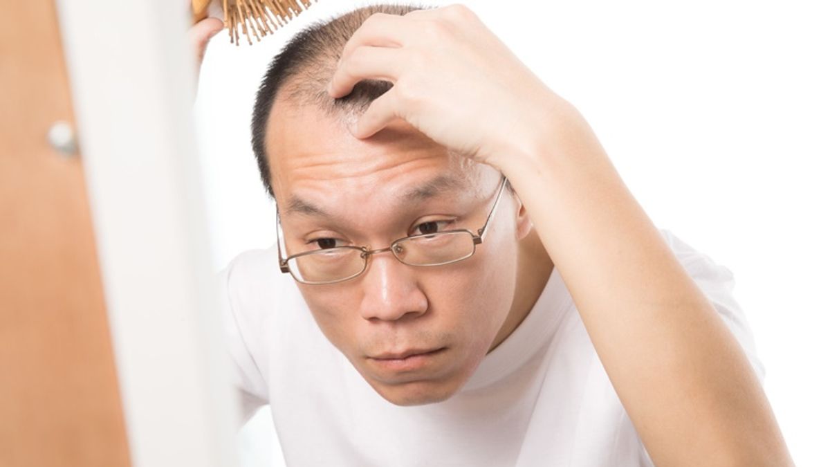 造成雄性禿有2個真正原因,主要是和基因遺傳與雄性賀爾蒙(二氫睪固酮)有關。(圖/pakutaso) 造成雄性禿有2個真正原因,主要是和基因遺傳與雄性賀爾蒙(二氫睪固酮)有關。(圖/pakutaso)