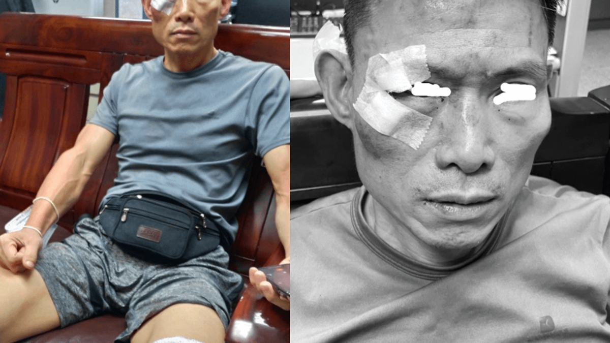 黃男遭盤查時予以激烈反抗,也未表明自己的身分,因此翁員更加認定他就是通緝犯李男。(圖/翻攝黃男家屬臉書) 黃男遭盤查時予以激烈反抗,也未表明自己的身分,因此翁員更加認定他就是通緝犯李男。(圖/翻攝黃男家屬臉書)