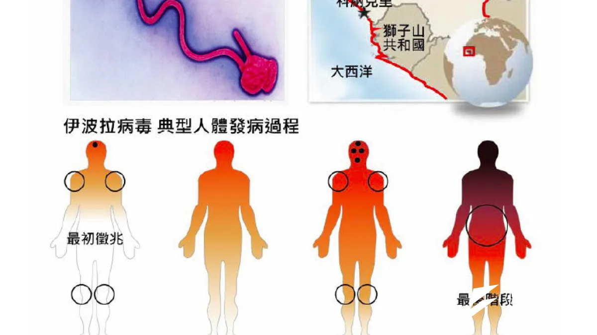點選放大鍵可見完整說明。