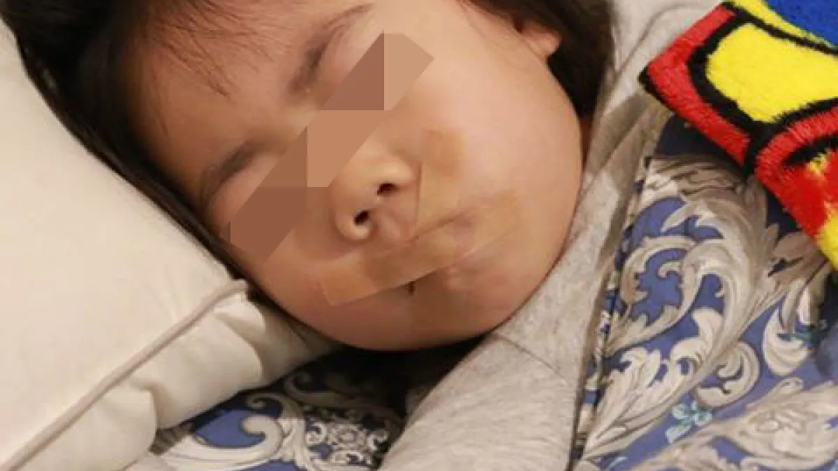 鰻魚媽曾用膠帶貼住女兒的嘴,盼她用鼻呼吸,遭質疑虐童。(取自鰻魚家家酒臉書)