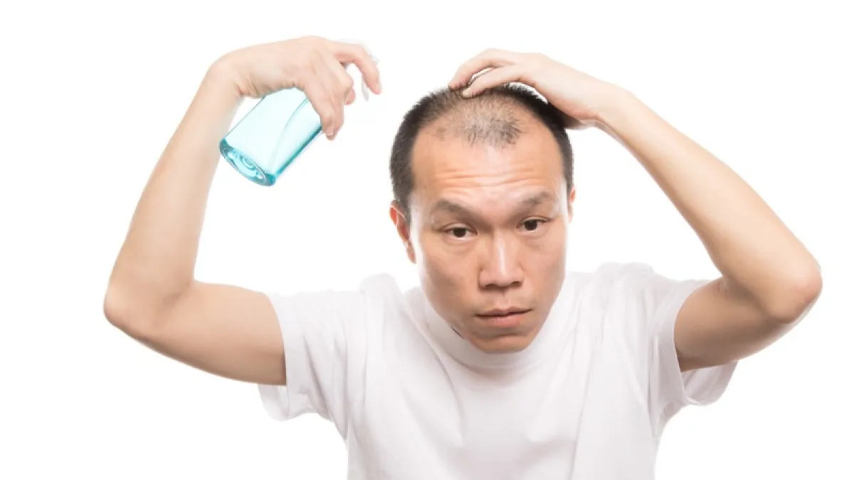 男性「狂落髮」還有得救嗎?專家:4項治療有助緩解落髮(示意圖/取自pakutaso)