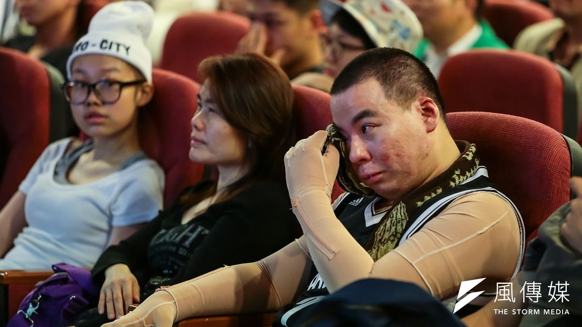 三軍總醫院日前舉辦「八仙塵爆傷患重生聖誕感恩」記者會,傷患感動落淚。(顏麟宇攝) 三軍總醫院日前舉辦「八仙塵爆傷患重生聖誕感恩」記者會,傷患感動落淚。(顏麟宇攝)