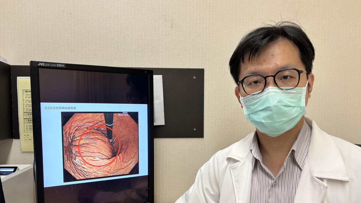 腹部長期悶脹別輕忽!恐是惡性「基質瘤」找上門 醫:早期難以察覺