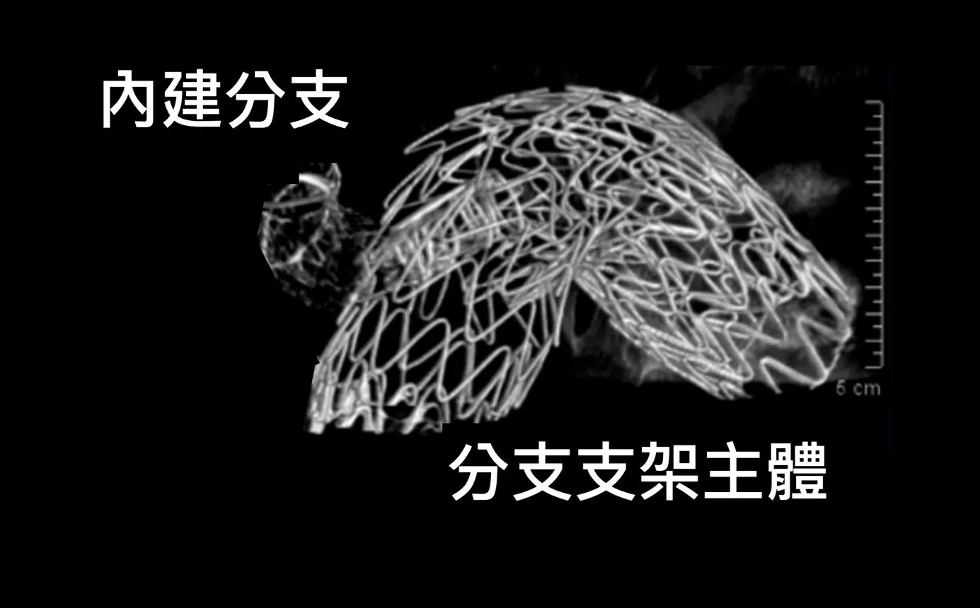 20250619-胸主動脈分支支架手術中3D即時重組圖。（長庚醫院提供）
