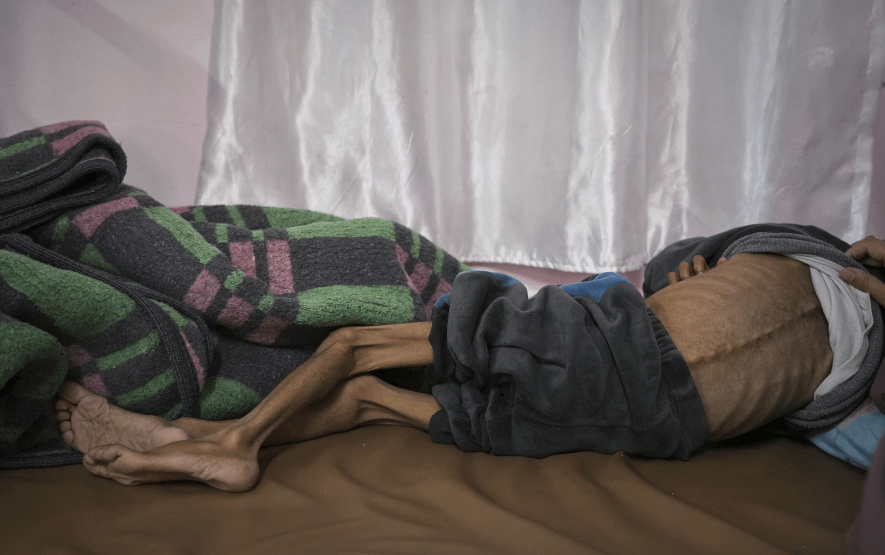 ガザを襲う飢饉。国連によれば90万人のガザの子供が長期の飢餓にさらされ、7万人が栄養失調の兆候を示している。（AP）