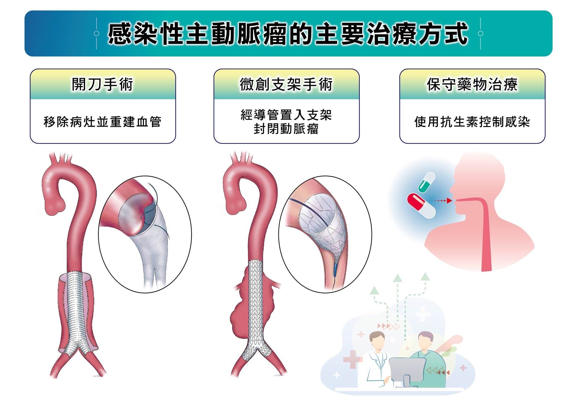 20251031-感染性主動脈瘤的3種主要治療方式：開刀手術、血管內微創修補以及保守藥物治療，不同方法各有適用情況，醫師會依病人的整體健康狀況與疾病特性，選擇最合適的治療方案。(長庚醫院提供)