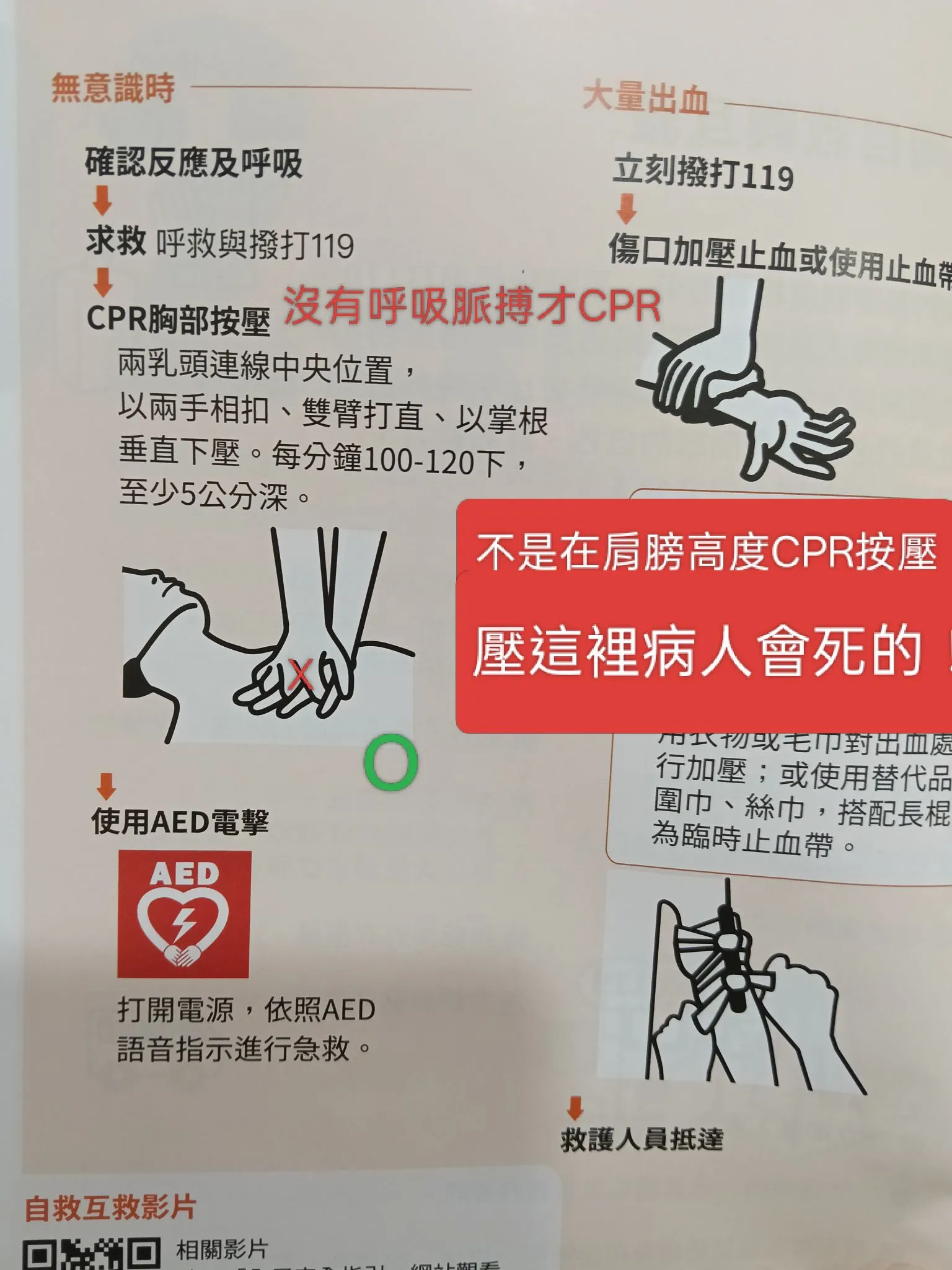 蘇一峰提醒，CPR如果壓在肩膀高度會害死人。（取自蘇一峰臉書）