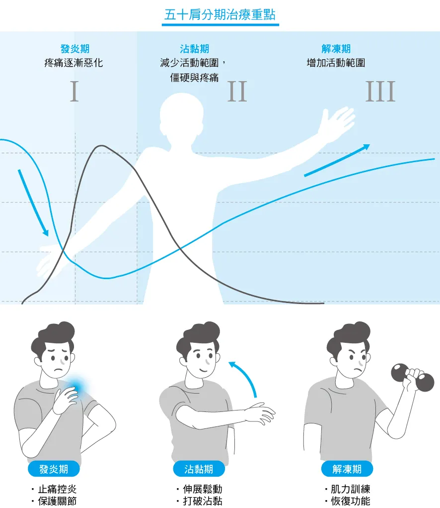 五十肩治療指南（圖／新自然主義）