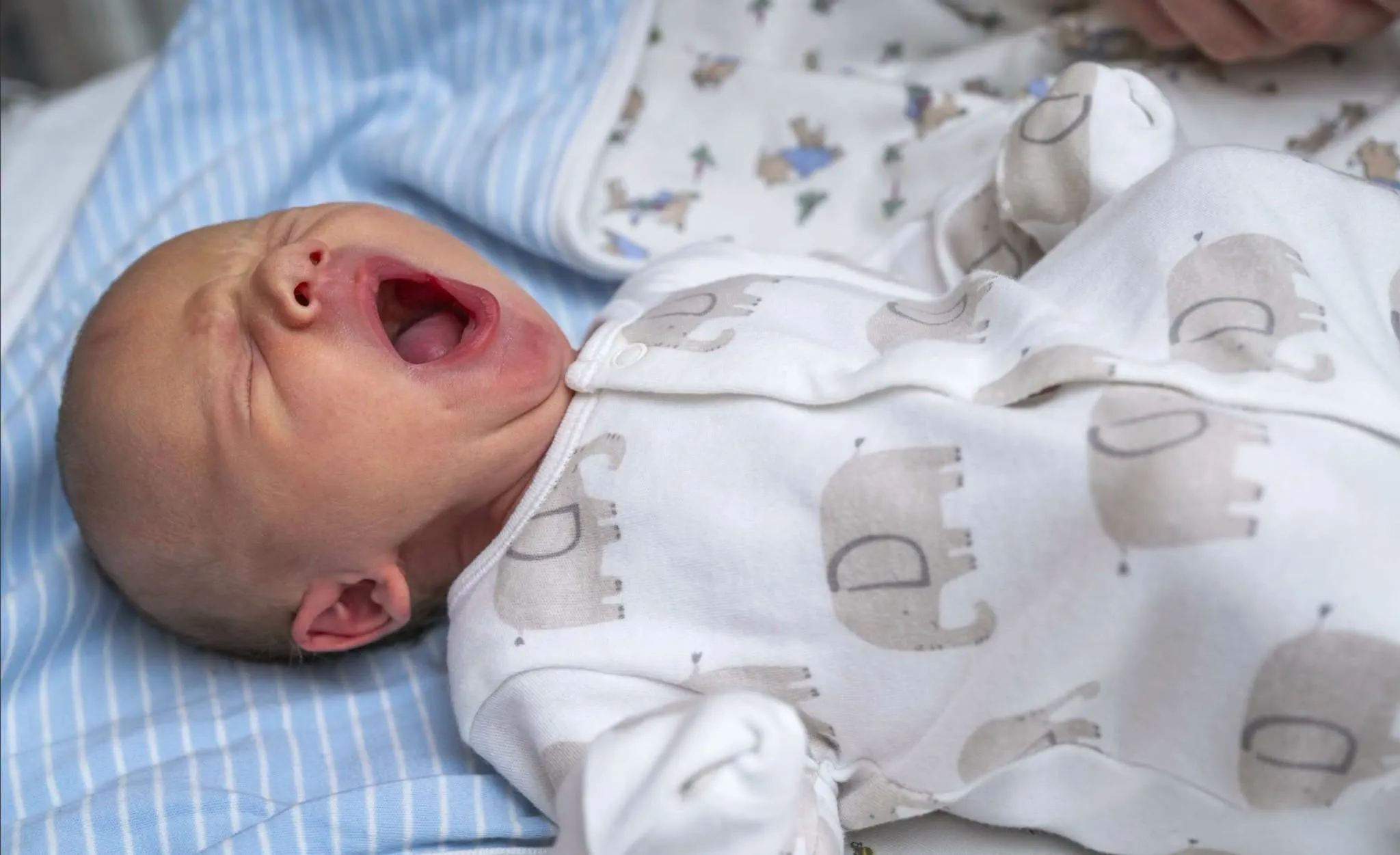 患有腹裂症(gastroschisis)的西奧(Theo),這種症狀是因為肚臍未能正常發育,導致腸臟長出體外。(翻攝德州兒童醫院臉書)