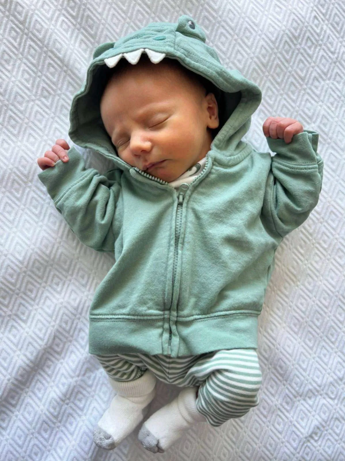 患有腹裂症(gastroschisis)的西奧(Theo),這種症狀是因為肚臍未能正常發育,導致腸臟長出體外。(翻攝德州兒童醫院臉書)