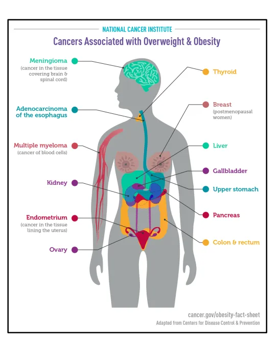 Cancers associated with overweight and obesity.(Provided by NTUH)