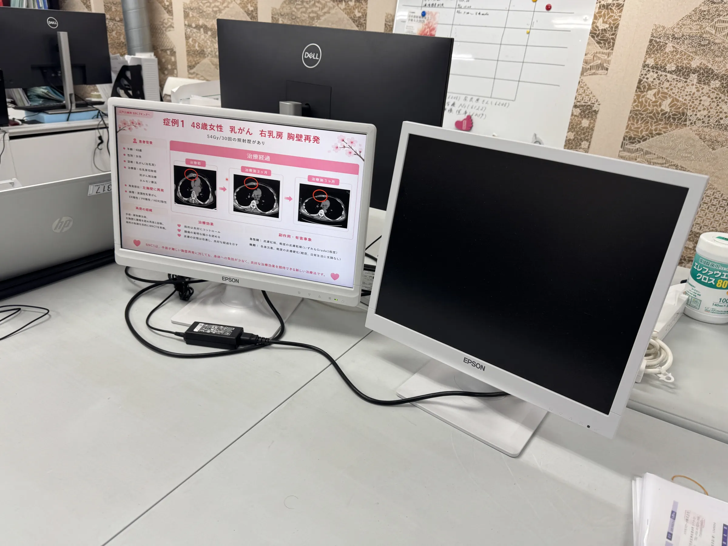 江戸川病院のBNCT乳がん治療は高い細胞選択性と安全性を示し、海外患者の受け入れ態勢を整えながら着実な成果を上げている。黃信維