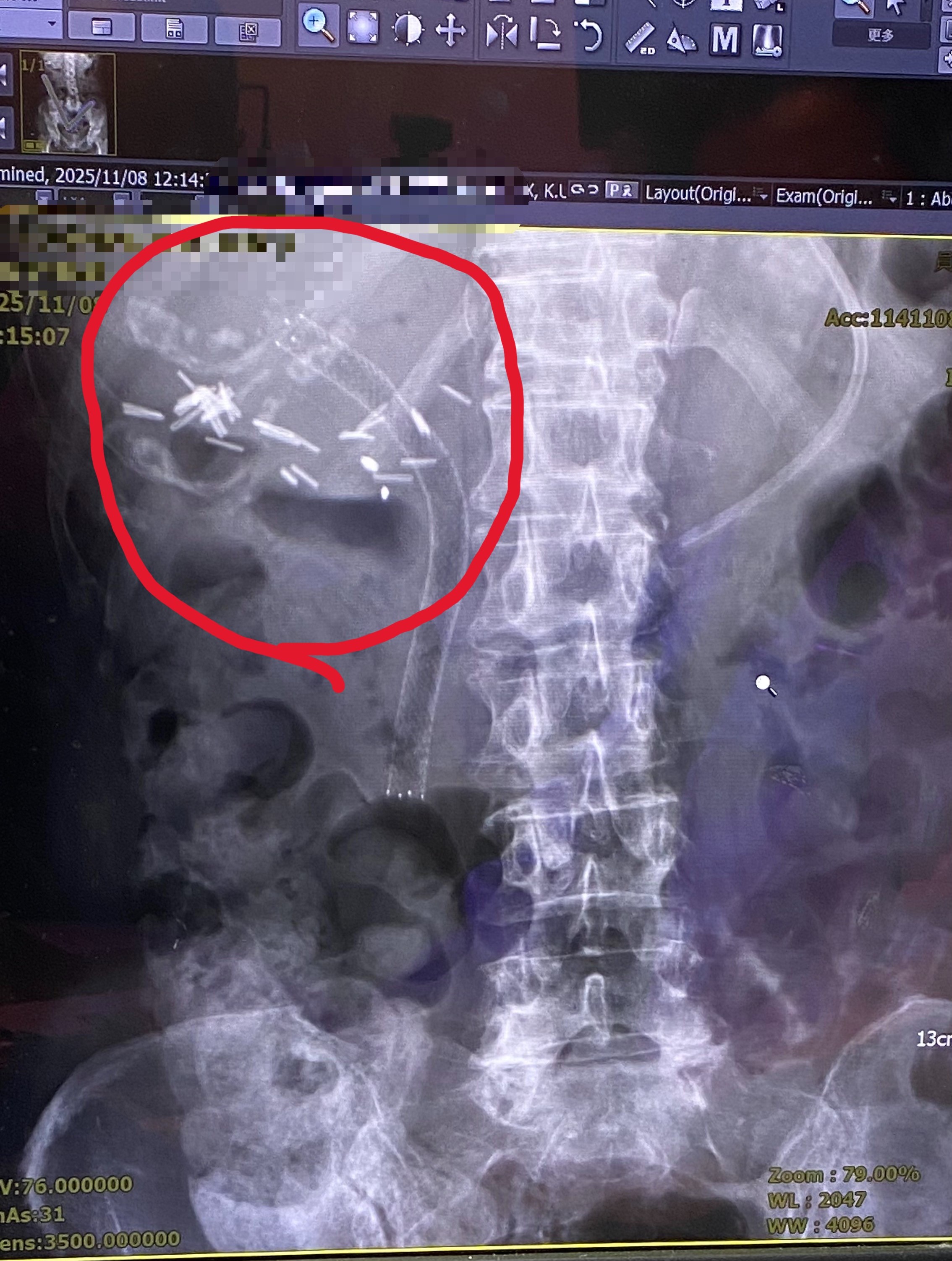 投資人注意！CME交易所大當機，海外期貨市場亂成一團| 林彥呈| 財經- 風傳媒